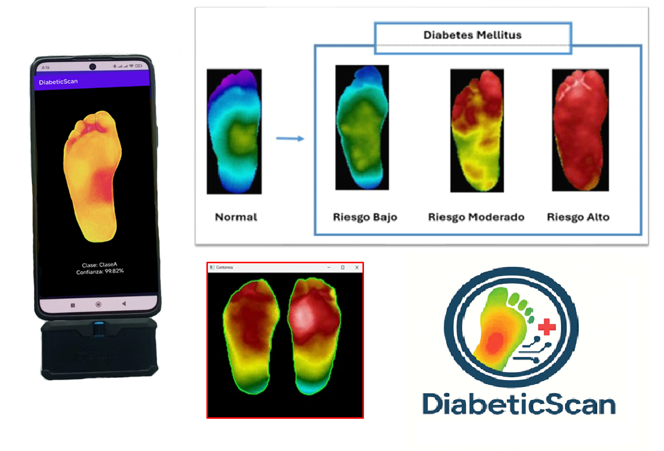 DiabeticScan